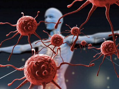 Особливий тип болю в тілі є однією з найпоширеніших ознак раку