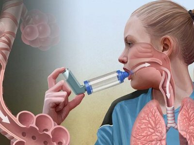 7 речей, які потрібно знати кожному, хто страждає на астму