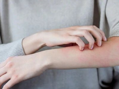 Стрес і шкіра: які захворювання провокують нерви і як з цим боротися 