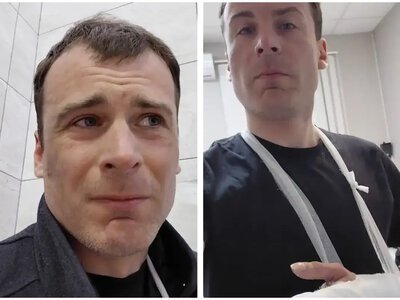 Повз по вулиці від болю: в Одесі заброньований артист звинувачує ТЦК у каліцтві