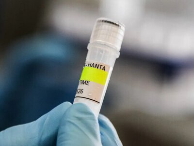 Перший випадок хантавірусу у Франції виявили в евакуйованої пасажирки лайнера