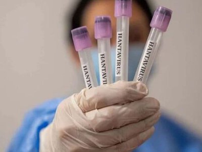 Хантавірус в Україні: що відомо про реальну кількість інфікованих