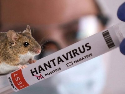 Понад 60 випадків зараження хантавірусом виявили в Україні цього року