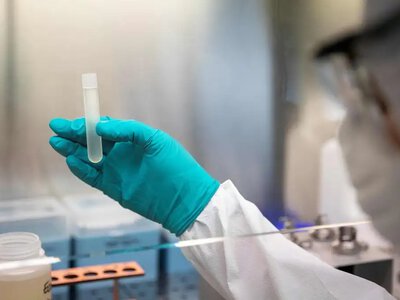 На Рівненщині розпочали посилений нагляд за холерою: фахівці перевіряють водойми