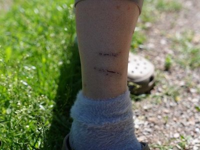 На Дніпропетровщині людей атакують заражені тварини: що відомо про ситуацію зі сказом в області