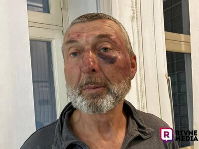 Побиття афганця на Рівненщині: у ТЦК призначили службову перевірку