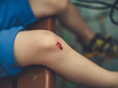 У Вінниці суд ухвалив рішення щодо неповнолітньої учасниці бійки в торговому центрі