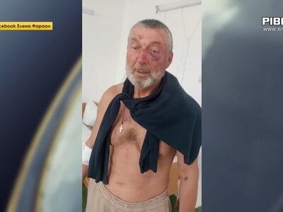 Що відомо про побиття ветерана від працівників ТЦК на Рівненщині (ВІДЕО)