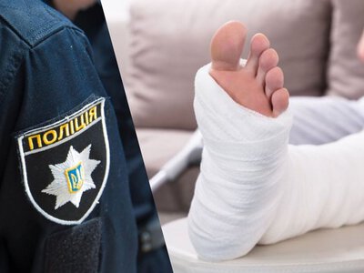 Ловили аж у Чугуєві: з харківської лікарні з гіпсом на обох ногах утік підозрюваний у розбої