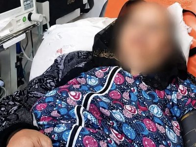 На Закарпатті гадюка вкусила 74-річну жінку просто у власному дворі