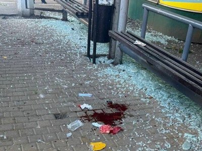 Зранку в Одесі росіяни поцілили в зупинку транспорту й поранили людей