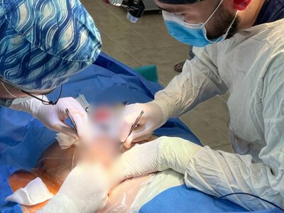 На Закарпатті вперше провели унікальну реконструкцію нижньої щелепи військовому (ФОТО)