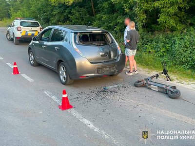 У Рівному 14-річний хлопець на електросамокаті врізався в авто: підлітка госпіталізували