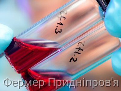 130 зареєстрованих нових випадків інфікування ВІЛ у травні - сумна статистика нашої області 