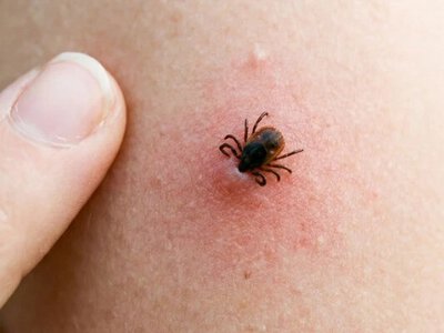 Чому кліщ може заразити в перші кілька годин