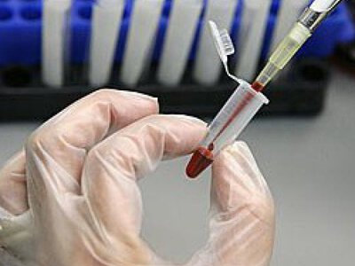 В Україні два роки поспіль не реєструють випадків холери, — ЦГЗ