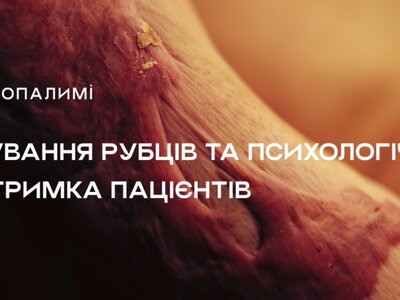Як підтримати близького після поранення: 5 порад від координаторки психологічного напрямку “Неопалимих”