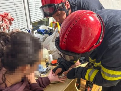 У Вінниці рятувальники допомогли жінці зняти каблучку через сильний набряк пальця