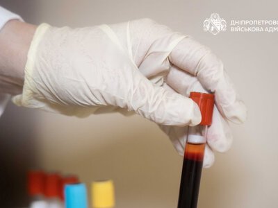 «Скринінг здоров'я 40+» на Дніпропетровщині: скільки людей безкоштовно пройшли медогляд