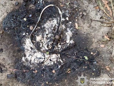 На Хмельниччині 11-річний хлопчик травмувався через вибух невідомого предмета