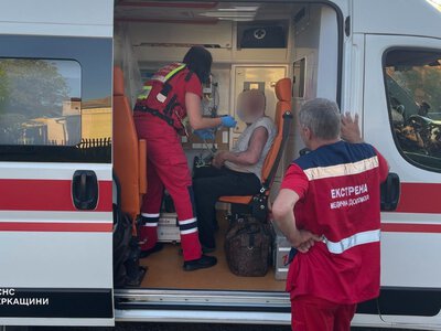 У Христинівці під час пожежі чоловік отримав опіки обличчя