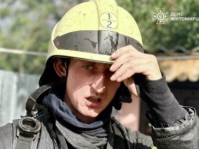 У Житомирі горів приватний будинок, є травмований чоловік