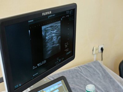 У міській поліклініці №4 в Івано-Франківську встановили новий  апарат УЗД