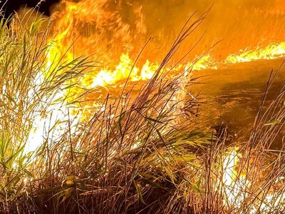 На Вінниччині госпіталузвали дівчинку, яка постраждала в результаті пожежі