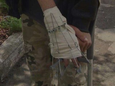 Це зробили в Україні: пораненому військовому створили протез, аналогів якому майже немає
