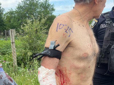 Коли рахунок іде на хвилини: на Сумщині поліцейські врятували пораненого після влучання БпЛА чоловіка