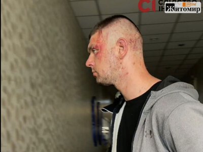 Вигуки «Слава ТЦК» після конфлікту у Львові спричинили гостру дискусію в мережі
