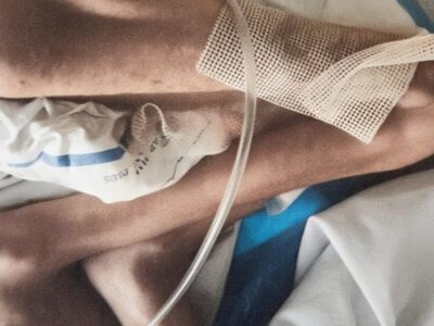 Ще одна смерть від голоду –  хлопчик з Чернівців помер в лікарні
