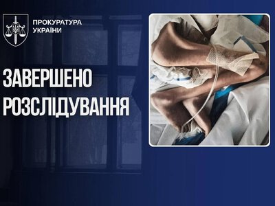 На Буковині судять матір, чий син помер від виснаження