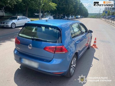 У Житомирі пенсіонерка потрапила до лікарні після наїзду автомобіля