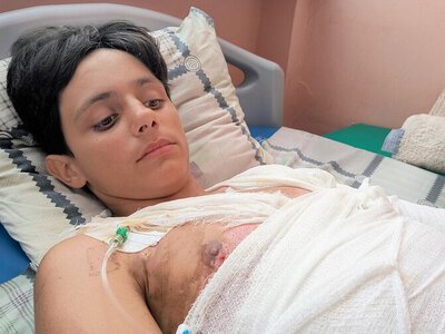 Одеський підліток отримав 45% опіків тіла, коли намагався зробити селфі на даху електрички: хлопця лікують у Львові