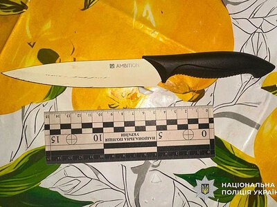 У Миколаєві жінка вдарила сусідку ножем у живіт під час конфлікту через собаку