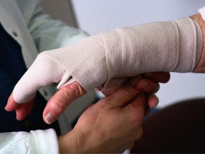 Двоє чоловіків отримали опіки під час пожежі у Рівненському районі
