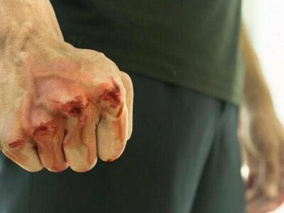 Напад серед білого дня у Києві: доньку відомого журналіста вдарили на зупинці