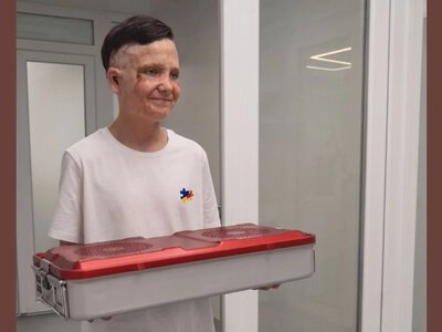 Рома Олексів передав опіковому центру спеціальні інструменти