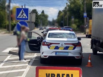 У Житомирі 59-річний пішохід потрапив до травматології після наїзду легковика