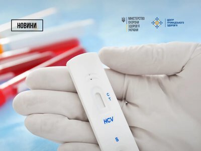 В Україні розпочався Тиждень тестування на вірусні гепатити: де і як протестуватись