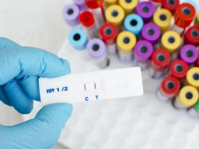 Жителів Рівненщини закликають безкоштовно пройти тестування на гепатити