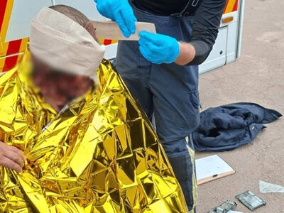 На Житомирщині росіяни атакували агропідприємство. Серед постраждалих — троє дітей