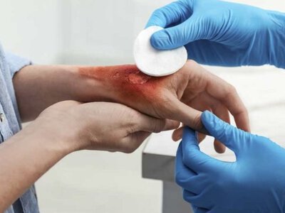 На Тячівщині чоловік отримав опіки через загоряння електрощитка