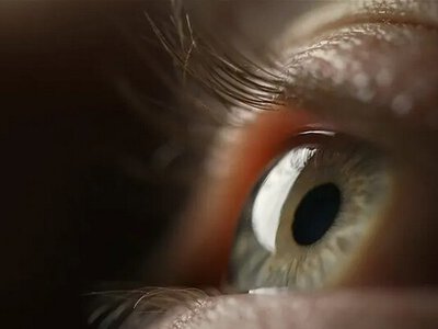Лікарі в Італії повернули зір пацієнтці, провівши першу в світі операцію з пересадки макули (ВІДЕО)