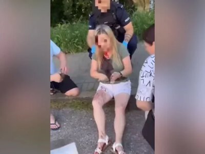 У польській Гдині невідомий двічі вдарив палицею по голові 40-річну українку