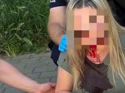 У Польщі знову невідомий жорстоко побив українку палицею