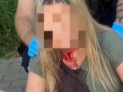 У Гдині невідомий двічі вдарив українку палицею по голові: поліція шукає нападника