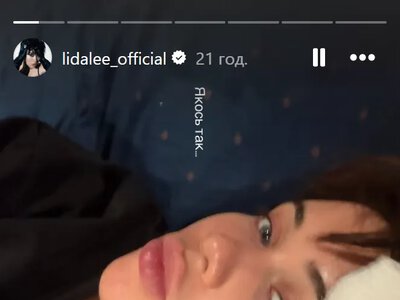 Lida Lee опинилася в гіпсі після загадкової травми: що сталося зі співачкою