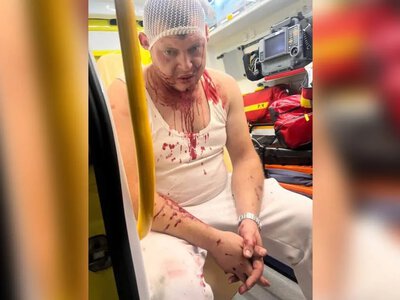 У Польщі жорстоко побили трьох українців